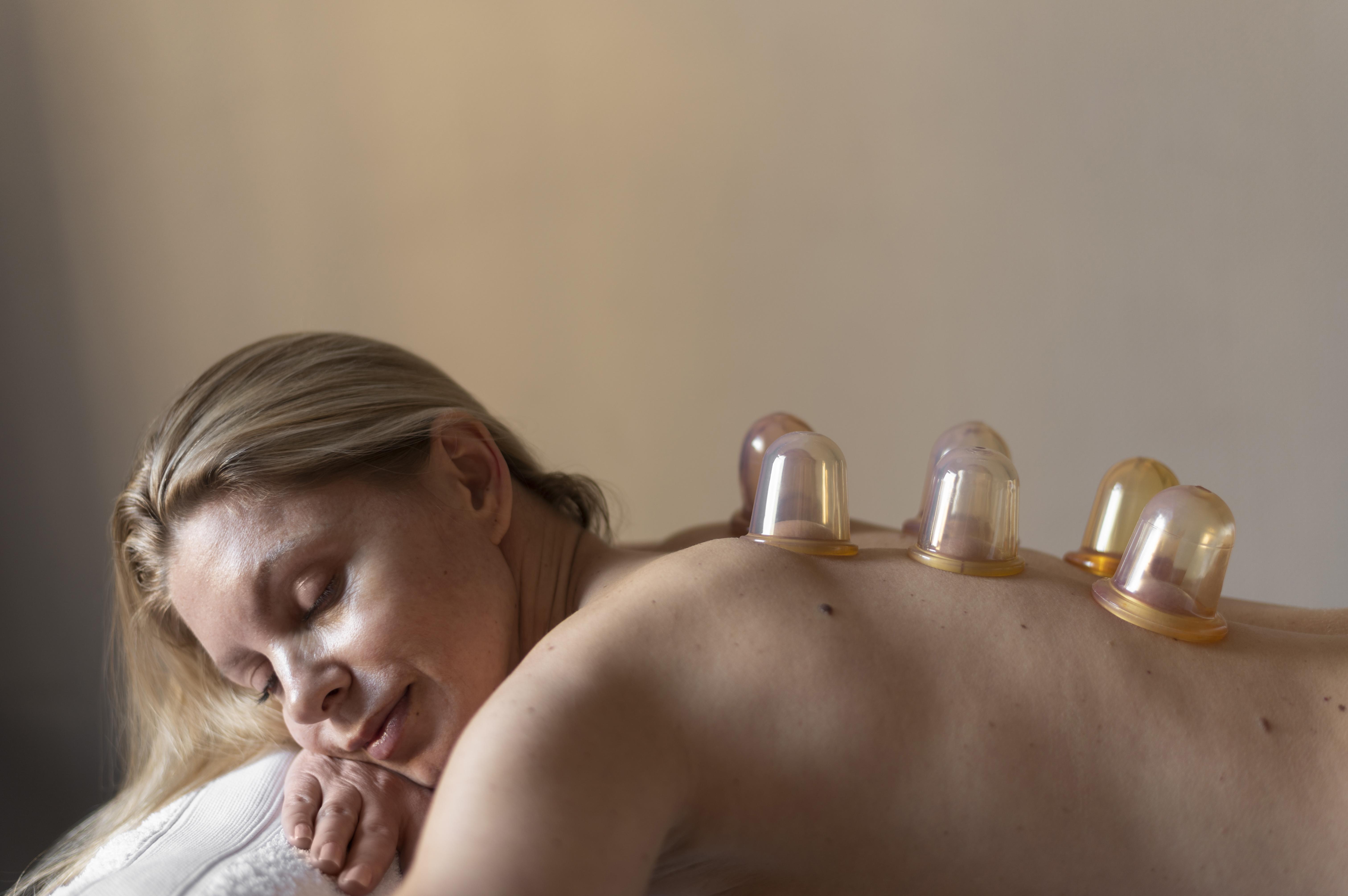 Cupping &ndash; en tradisjonell massasjeteknikk med moderne interesse